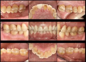 写真やアニメーションって何ですか?