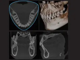 CTはありますか?