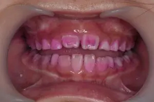 ブラッシングの方法を教えてもらえますか?