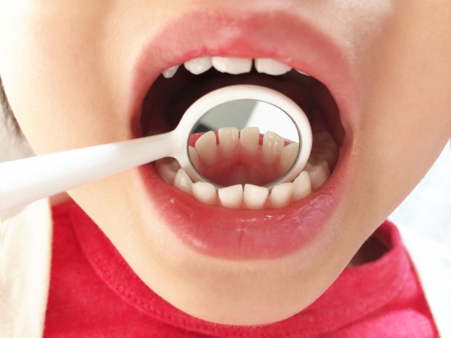 子どものむし歯事情