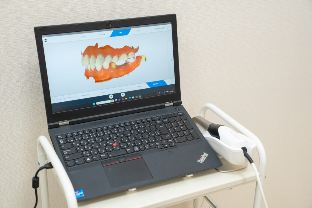 Primescan（プライムスキャン）