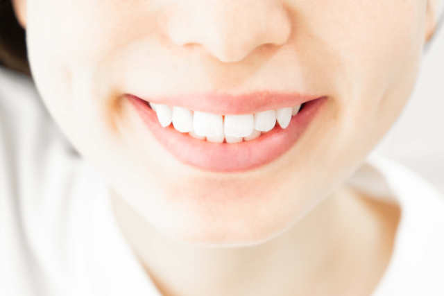 乱杭歯（叢生）・八重歯