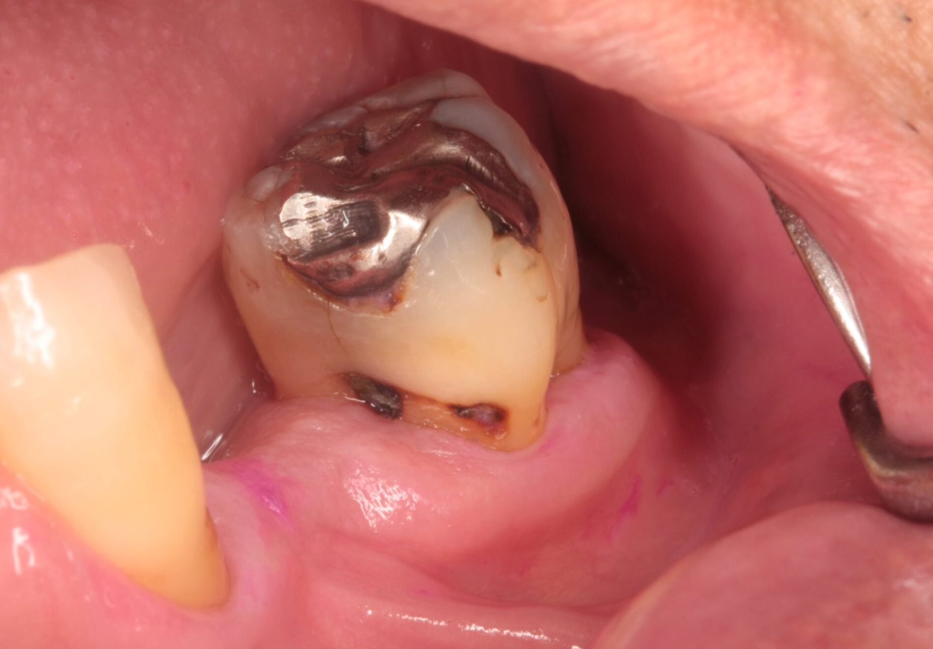 エビデンスに基づいた、当院の「守り続ける」アプローチ